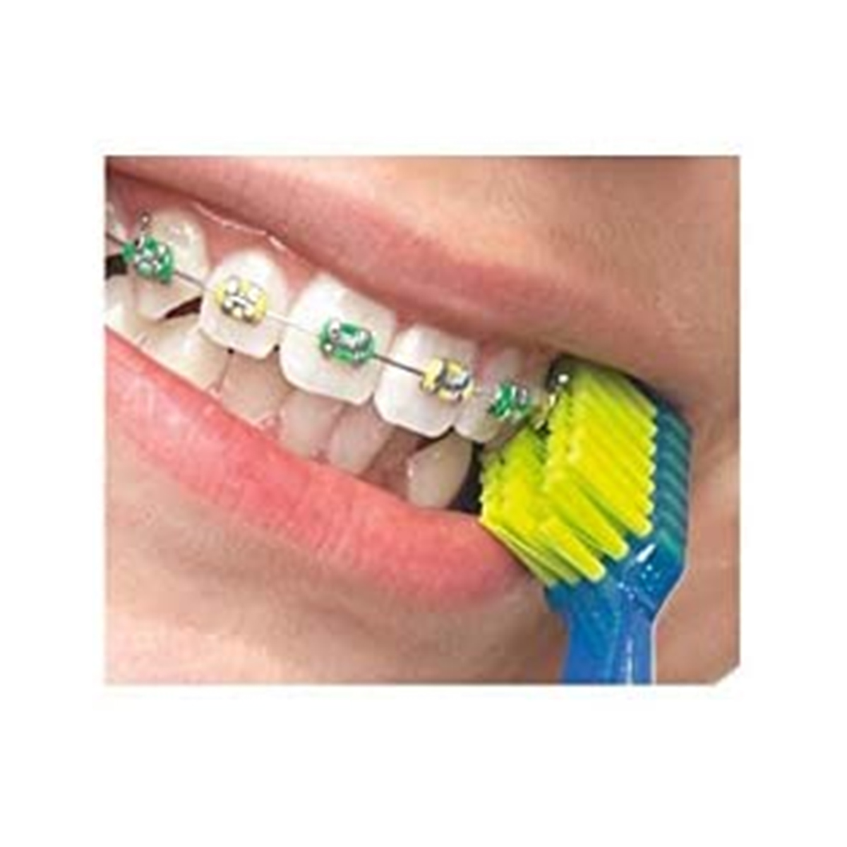 Curaprox - კურაპროქსი კბილის ჯაგრისი ბრეკეტის CS 5460 0077 2